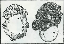 Рисунок 1. Бородавчатая болезнь клубней картофеля